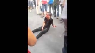شفار حصلوه طيرو ليه عينيه في البيضاء