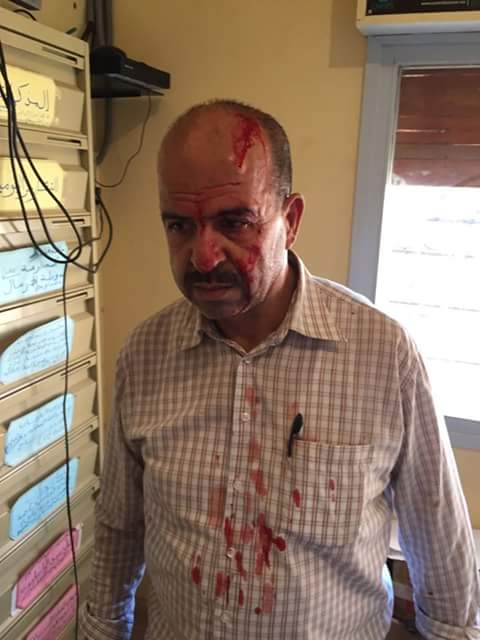 خنيفرة : اعتداء شنيع على ناظر ثانوية محمد السادس !؟