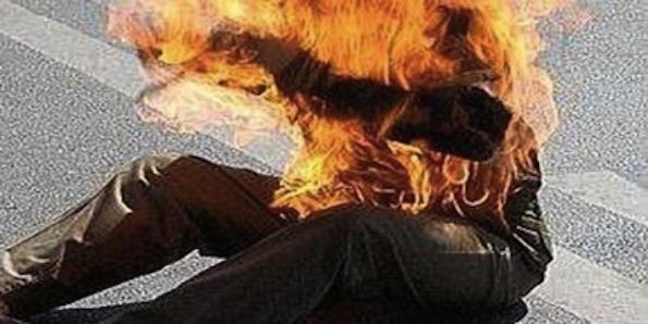 البيضاء : تلميذ يضرم النار في جسده  !؟