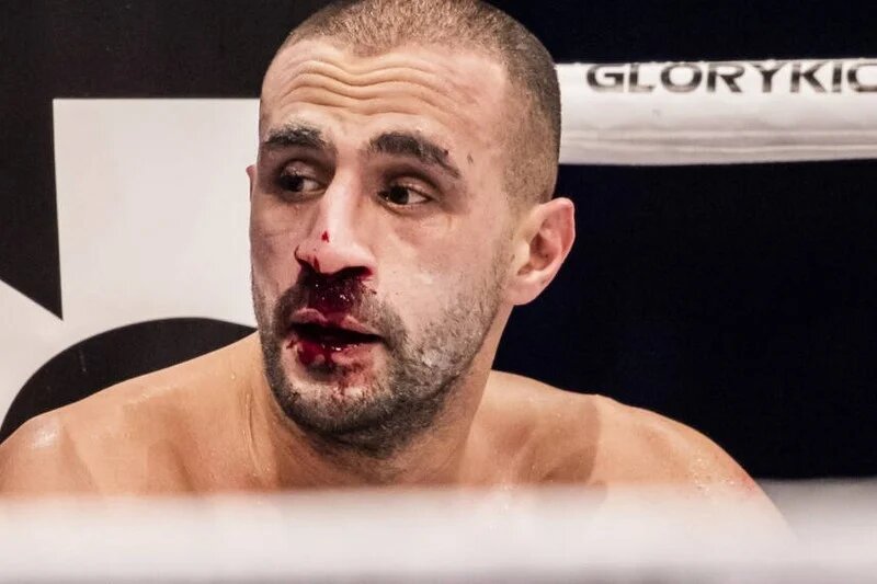 هكذا سقط البطل العالمي بدر هاري بالضربة القاضية في أمسية 